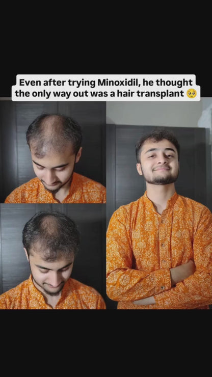 Hair Growth Blueprint